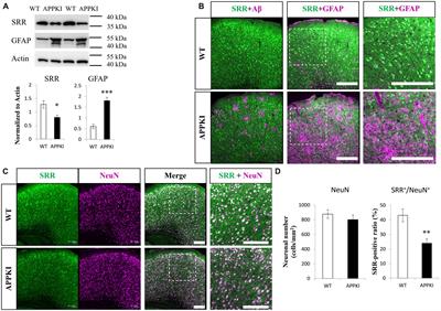 Regional contributions of D-serine to Alzheimer’s disease pathology in male AppNL–G–F/NL–G–F mice